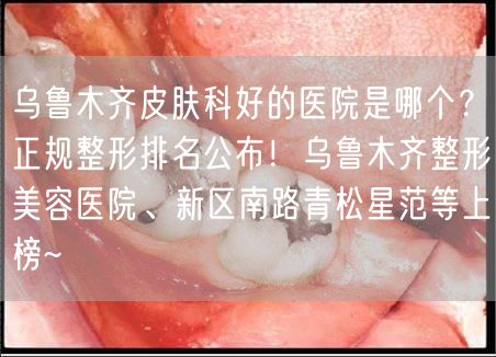 乌鲁木齐皮肤科好的医院是哪个？正规整形排名公布！乌鲁木齐整形美容医院、新区南路青松星范等上榜~