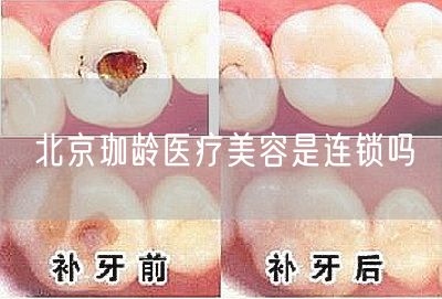 北京珈龄医疗美容是连锁吗