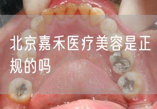 北京嘉禾医疗美容是正规的吗(图1)
