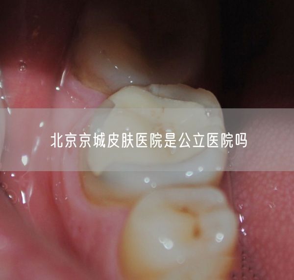 北京京城皮肤医院是公立医院吗