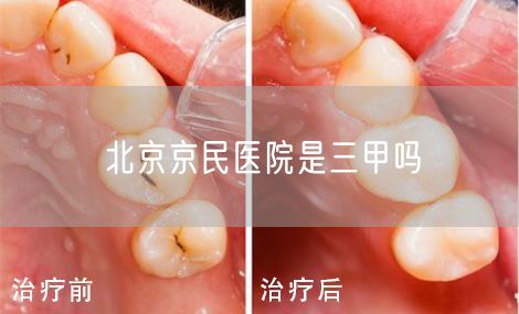 北京京民医院是三甲吗(图1)