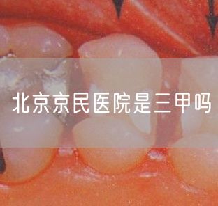 北京京民医院是三甲吗