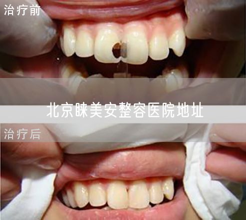 北京睐美安整容医院地址