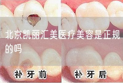北京凯丽汇美医疗美容是正规的吗