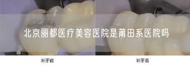 北京丽都医疗美容医院是莆田系医院吗