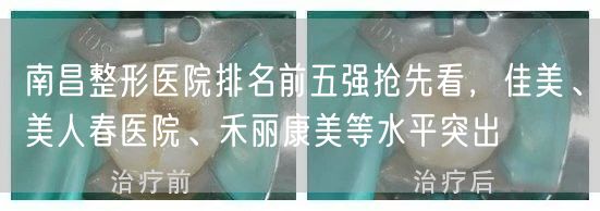 南昌整形医院排名前五强抢先看，佳美、美人春医院、禾丽康美等水平突出