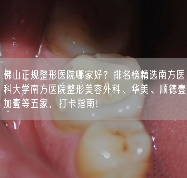 佛山正规整形医院哪家好？排名榜精选南方医科大学南方医院整形美容外科、华美、顺德壹加壹等五家，打卡指南！