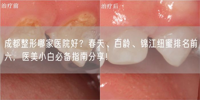 成都整形哪家医院好？春天、百龄、锦江纽蜜排名前六，医美小白必备指南分享！