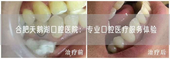 合肥天鹅湖口腔医院：专业口腔医疗服务体验(图1)