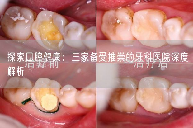 探索口腔健康：三家备受推崇的牙科医院深度解析(图1)