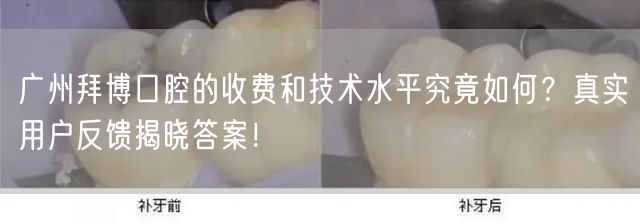 广州拜博口腔的收费和技术水平究竟如何？真实用户反馈揭晓答案！(图1)