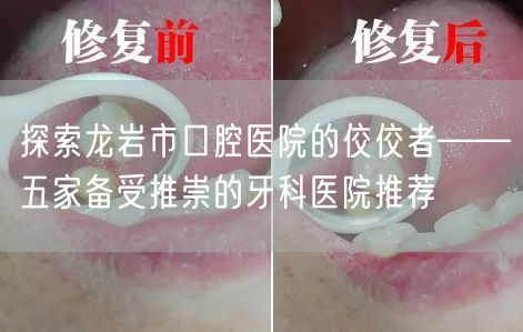 探索龙岩市口腔医院的佼佼者——五家备受推崇的牙科医院推荐(图1)