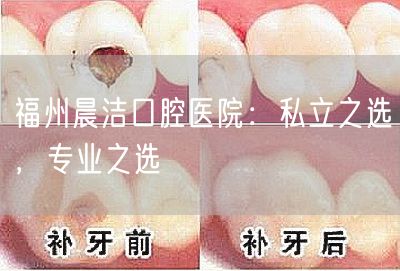 福州晨洁口腔医院：私立之选，专业之选(图1)