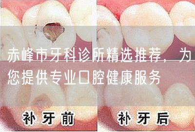 赤峰市牙科诊所精选推荐，为您提供专业口腔健康服务(图1)