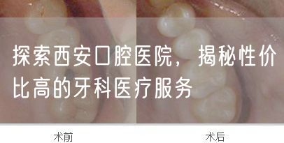 探索西安口腔医院，揭秘性价比高的牙科医疗服务