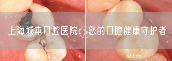 上海城本口腔医院：您的口腔健康守护者