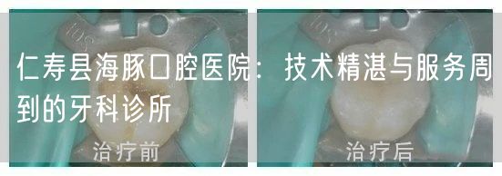 仁寿县海豚口腔医院：技术精湛与服务周到的牙科诊所