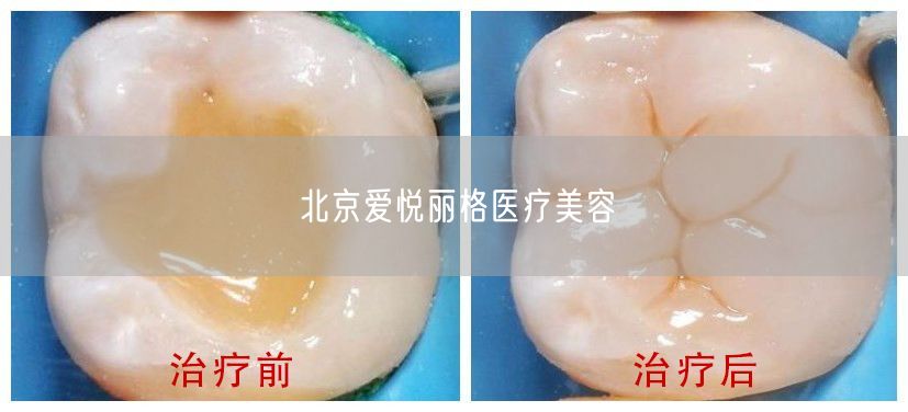 北京爱悦丽格医疗美容(图1)