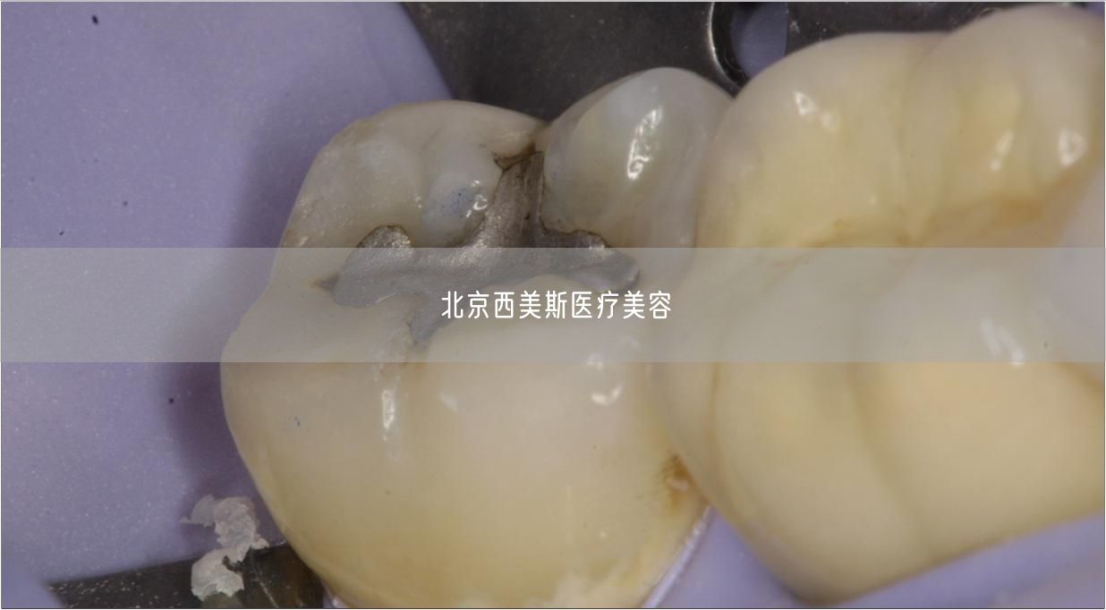 北京西美斯医疗美容(图1) 北京西美斯医疗美容(图1)