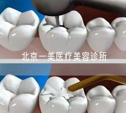 北京一美医疗美容诊所(图1) 北京一美医疗美容诊所(图1)