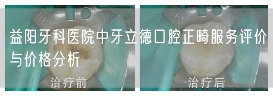 益阳牙科医院中牙立德口腔正畸服务评价与价格分析