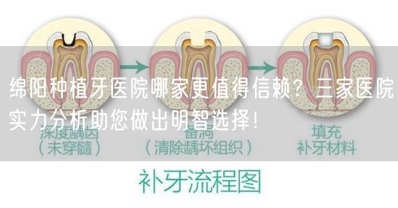 绵阳种植牙医院哪家更值得信赖？三家医院实力分析助您做出明智选择！