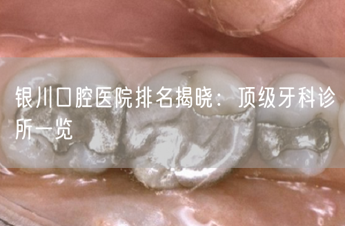 银川口腔医院排名揭晓：顶级牙科诊所一览