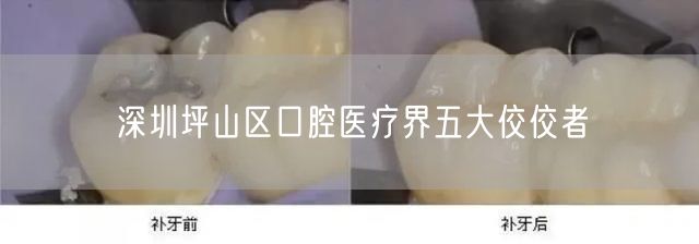 深圳坪山区口腔医疗界五大佼佼者(图1)