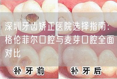 深圳牙齿矫正医院选择指南：格伦菲尔口腔与麦芽口腔全面对比