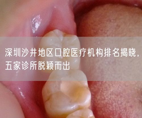 深圳沙井地区口腔医疗机构排名揭晓，五家诊所脱颖而出