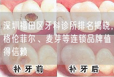 深圳福田区牙科诊所排名揭晓，格伦菲尔、麦芽等连锁品牌值得信赖