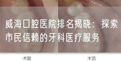 威海口腔医院排名揭晓:探索市民信赖的牙科医疗服务(图1) 威海口腔医院排名揭晓:探索市民信赖的牙科医疗服务(图1)
