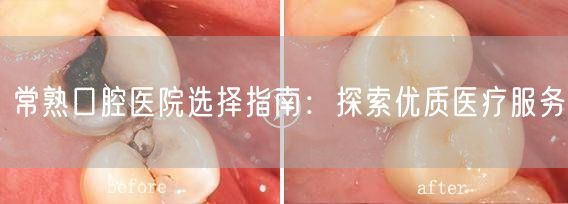 常熟口腔医院选择指南：探索优质医疗服务(图1)