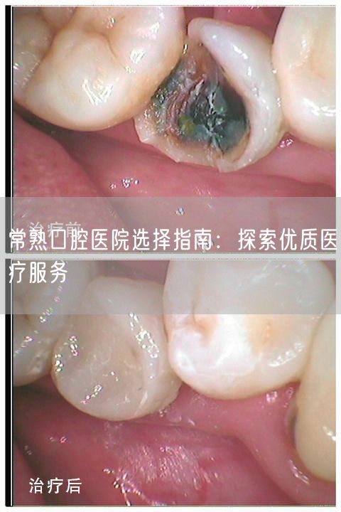 常熟口腔医院选择指南：探索优质医疗服务