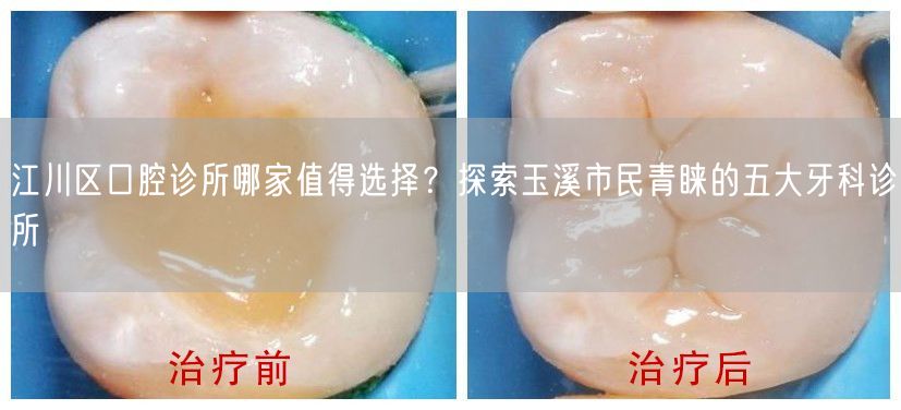 江川区口腔诊所哪家值得选择？探索玉溪市民青睐的五大牙科诊所