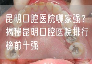 昆明口腔医院哪家强？揭秘昆明口腔医院排行榜前十强