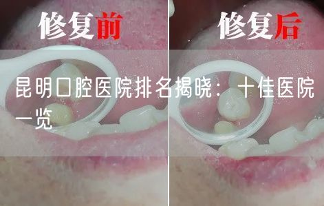昆明口腔医院排名揭晓：十佳医院一览
