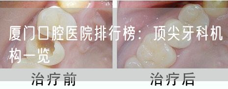 厦门口腔医院排行榜：顶尖牙科机构一览