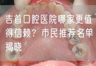 吉首口腔医院哪家更值得信赖？市民推荐名单揭晓