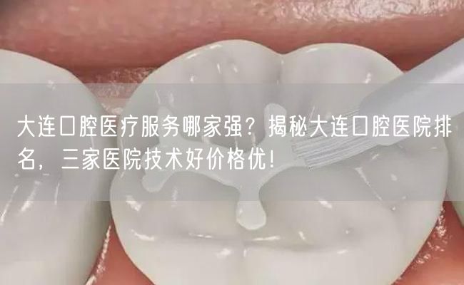 大连口腔医疗服务哪家强？揭秘大连口腔医院排名，三家医院技术好价格优！