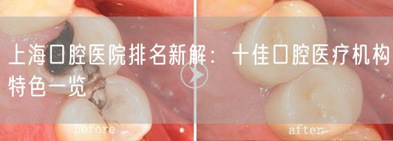 上海口腔医院排名新解：十佳口腔医疗机构特色一览