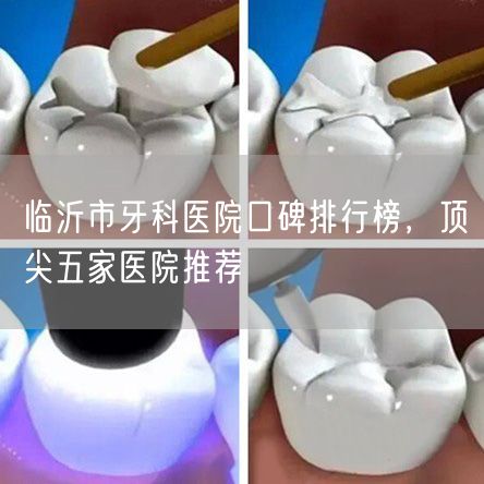 临沂市牙科医院口碑排行榜，顶尖五家医院推荐(图1)