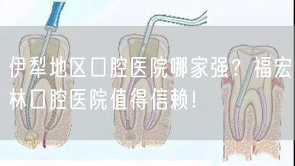 伊犁地区口腔医院哪家强？福宏林口腔医院值得信赖！(图1)