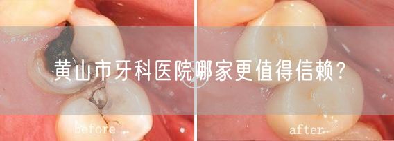 黄山市牙科医院哪家更值得信赖？(图1)