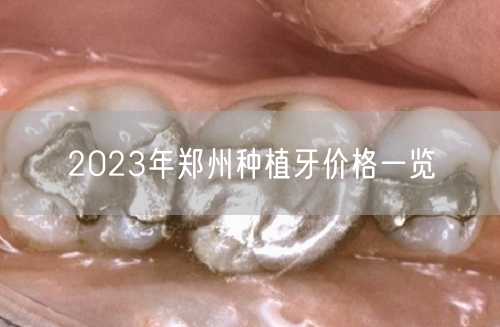 2023年郑州种植牙价格一览(图1)