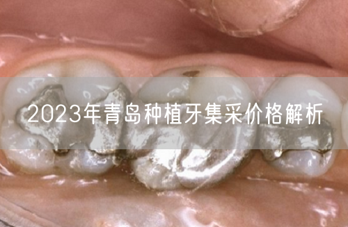 2023年青岛种植牙集采价格解析(图1)