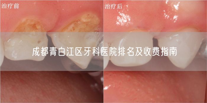 成都青白江区牙科医院排名及收费指南(图1)