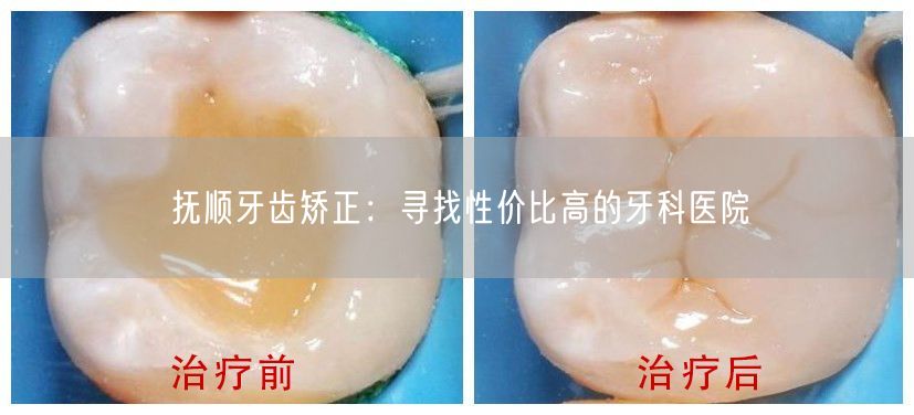 抚顺牙齿矫正：寻找性价比高的牙科医院(图1)