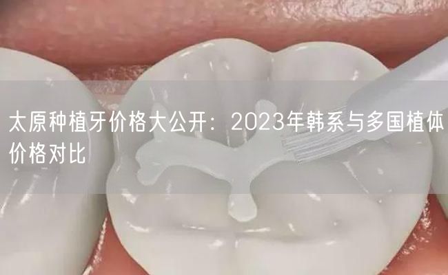 太原种植牙价格大公开：2023年韩系与多国植体价格对比(图1)