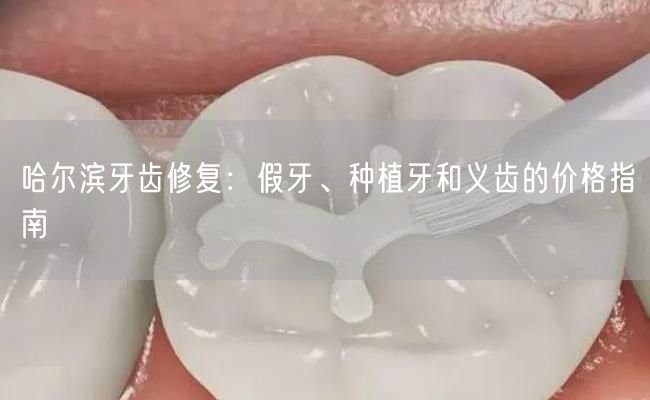 哈尔滨牙齿修复：假牙、种植牙和义齿的价格指南(图1)